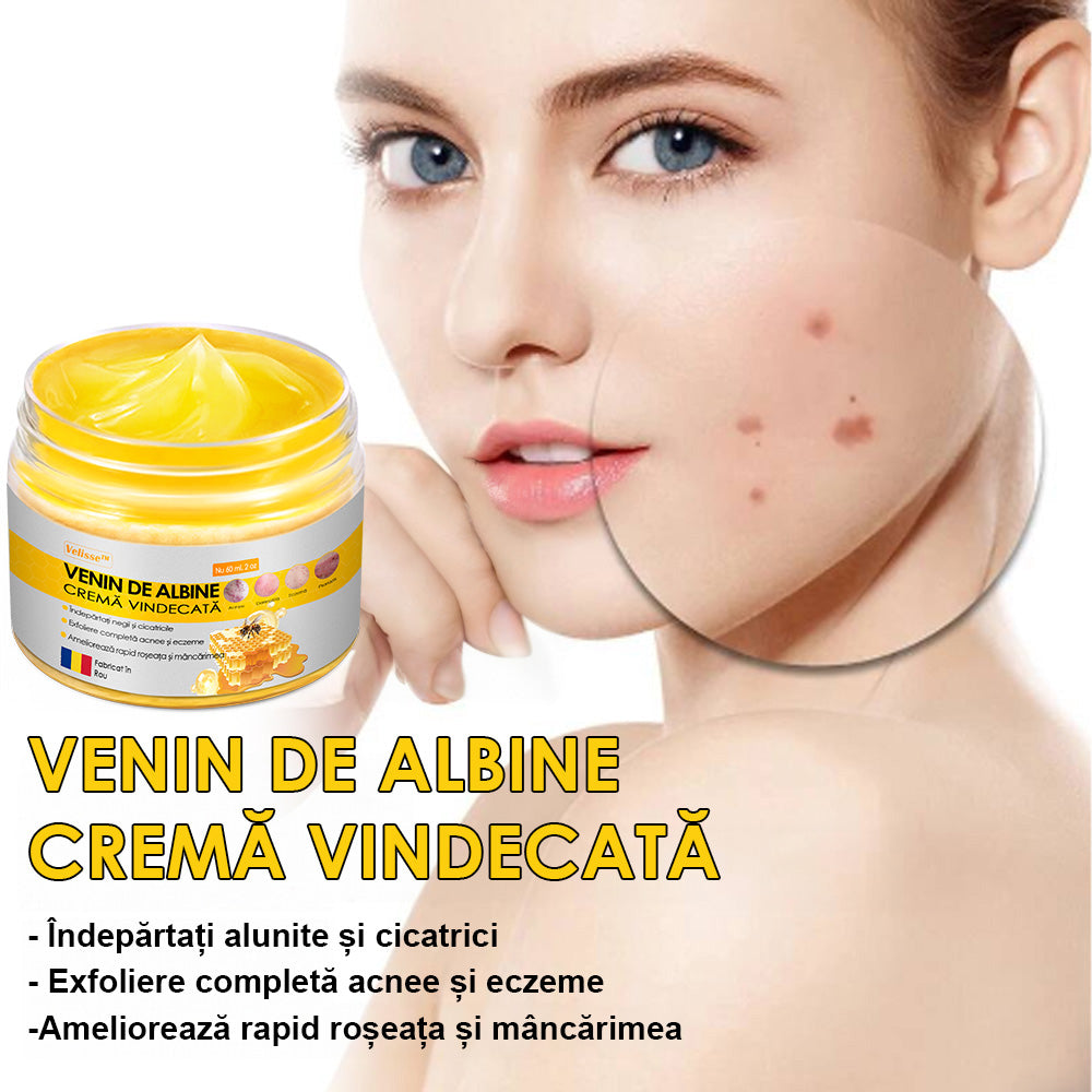 Velisse™ Cremă cu Venin de Albine, pentru Îndepărtarea Papiloamelor, Acneei și Cicatricilor - Tratament pentru Multe Probleme Ale Pielii (Recomandat de ADD)